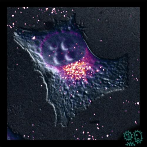 DIC microscopy 