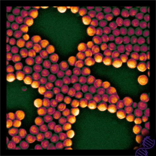 Electronic conductivity on electron microscopy