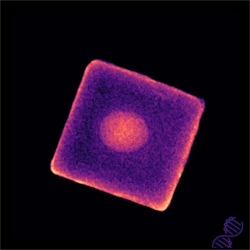 Upconverting nanoparticle and metal-organic-framework, finally together